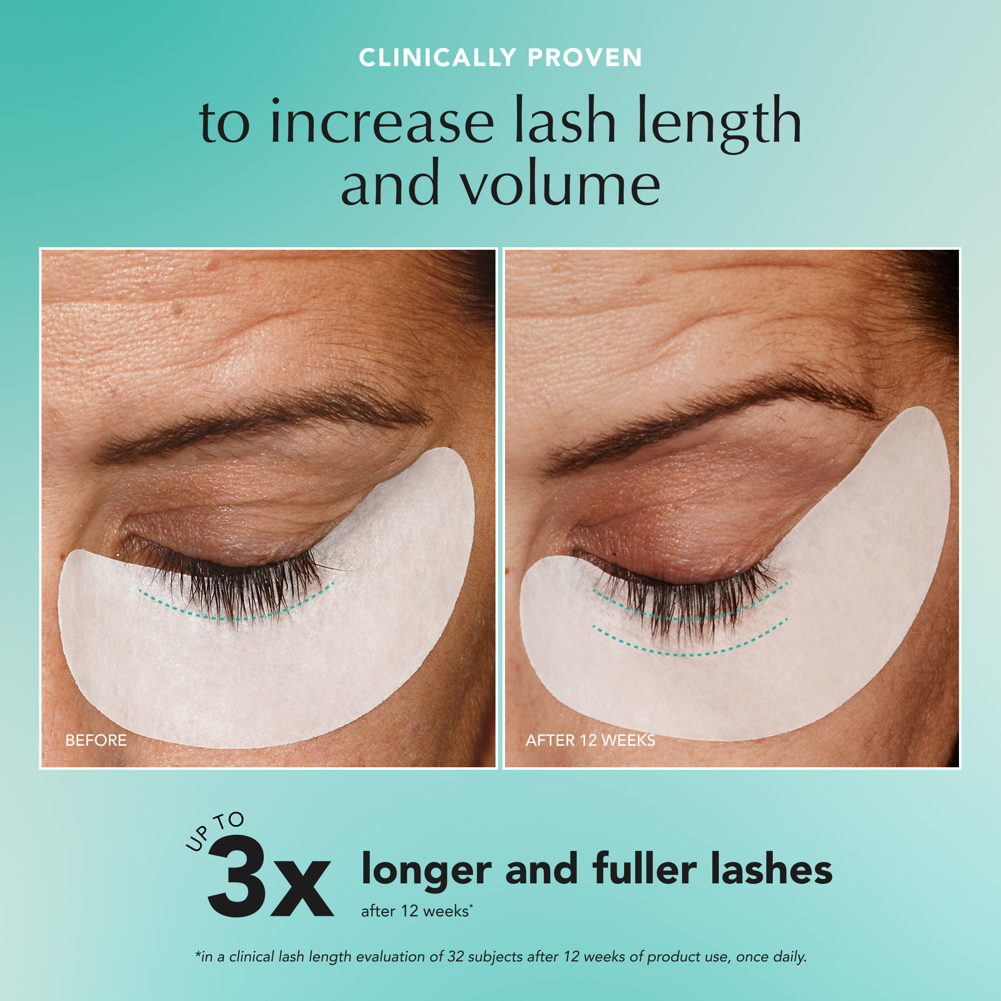 Image: Lash Serum | B+A | Lash Length